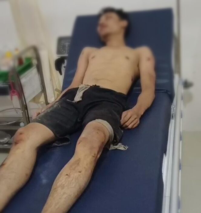 
					Pelaku Curanmor Dapat Hadiah Langsung di Permak Warga