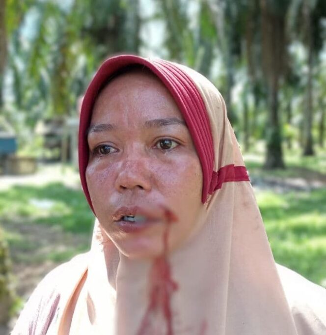 
					Dianiaya Oknum TNI, Ibu Rumah Tangga Lapor POM Angkatan Laut Lantamal I Belawan