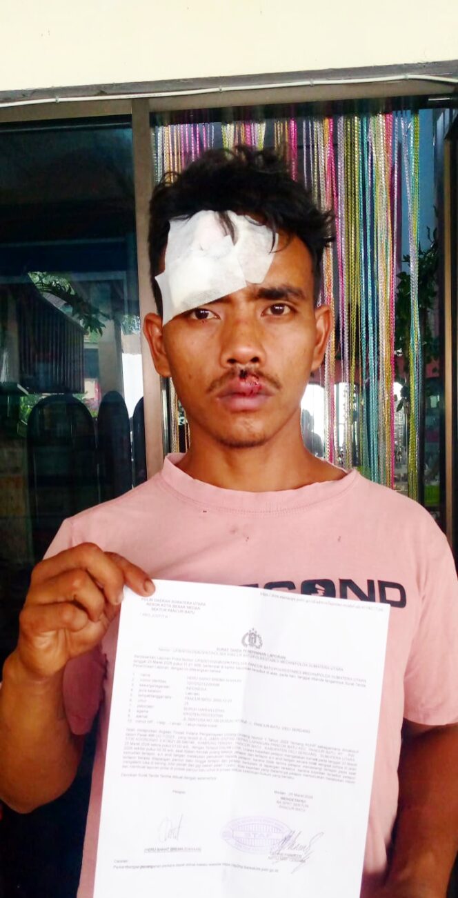 
					Brutal!! Jagoan Mabuk Diduga Aniaya Buruh, Warga Desak APH Segera Tangkap Pelaku