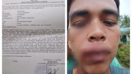 Foto kondisi wandana dugaan korban pengeroyokan beserta surat laporan nya ke polresta Deli Serdang.
