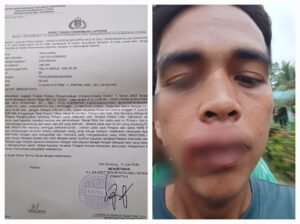 Foto kondisi wandana dugaan korban pengeroyokan beserta surat laporan nya ke polresta Deli Serdang.