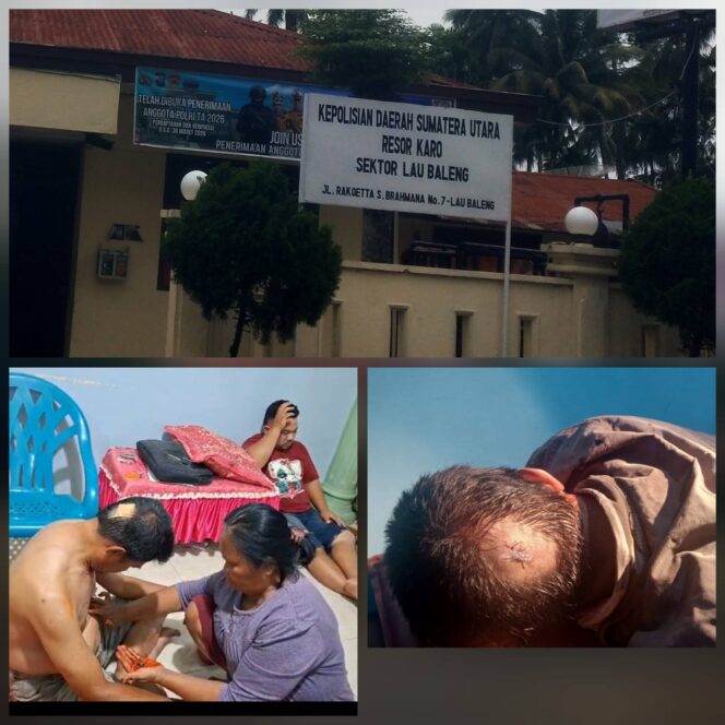 
					Pelaku Pembacokan Sarpen Sembiring di Mardinding Masih Bebas Berkeliaran, Keluarga Pertanyakan Kinerja Polisi